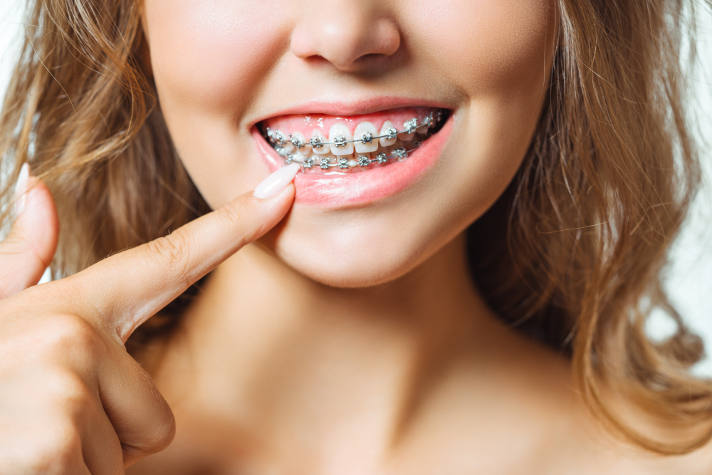 Orthodontic Exams