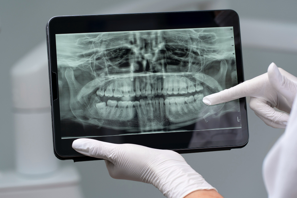 Digital X-Rays  Thousand Oaks, CA