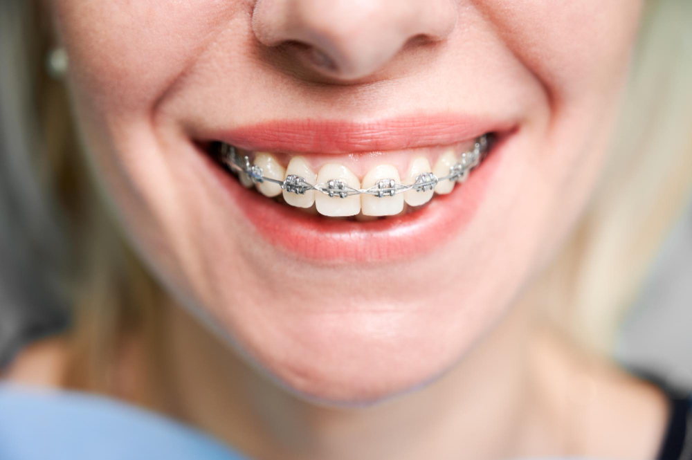 Orthodontics