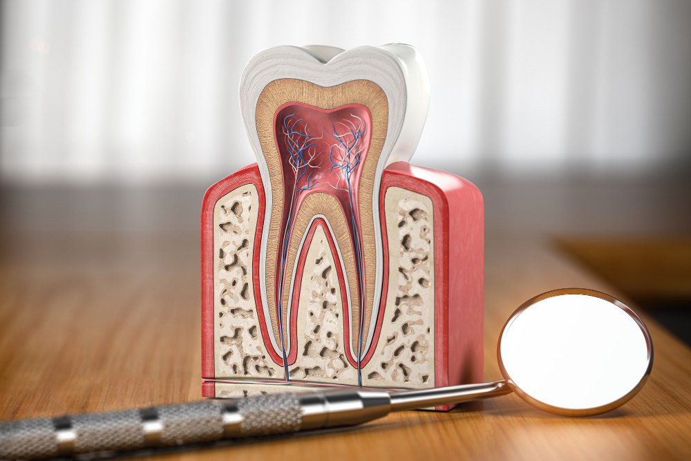 Root Canal Therapy